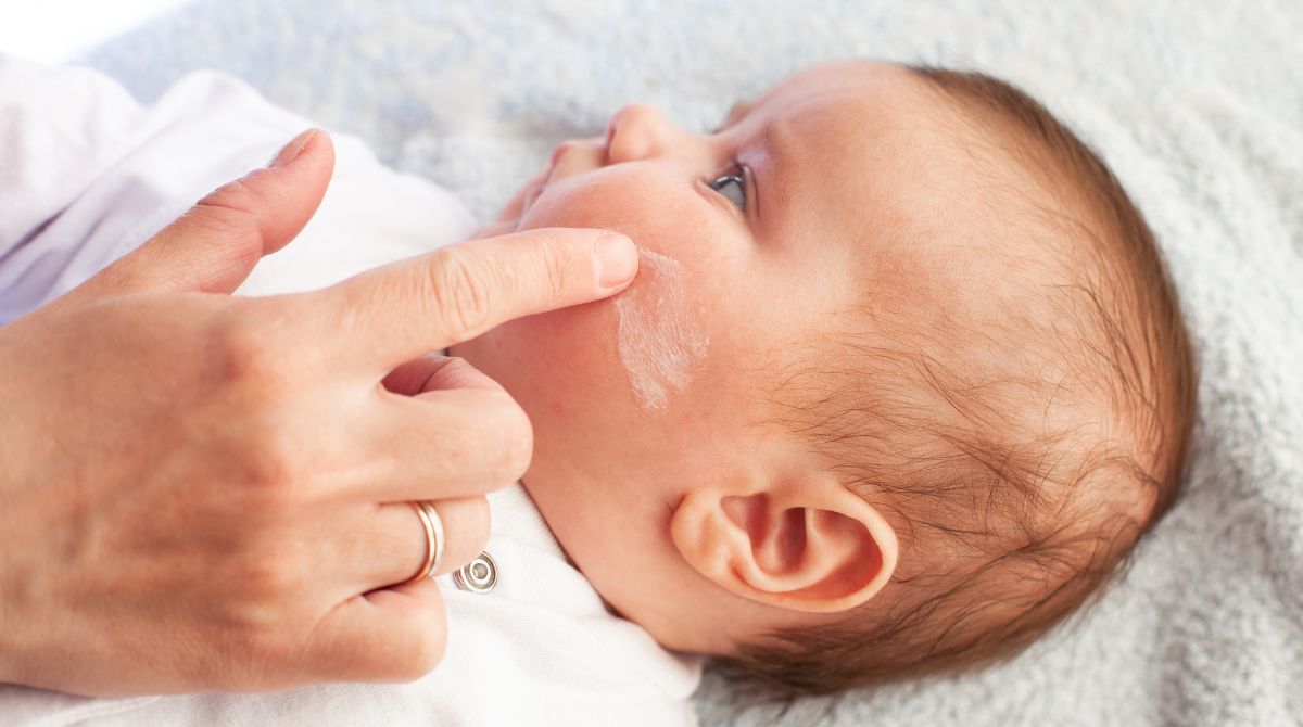 dampak dermatitis atopik pada anak, kulit anak gatal