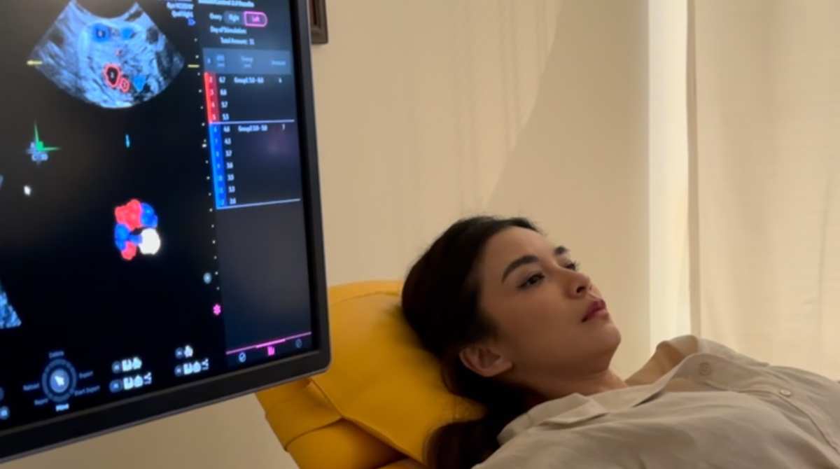 hamil kembar 8, chelsea olivia